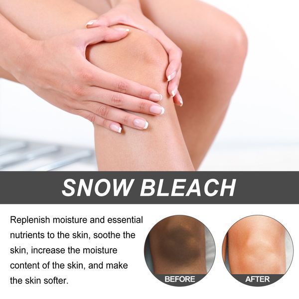 Отбеливающий крем для потемневших частей тела Snow Bleach Cream 065730 фото